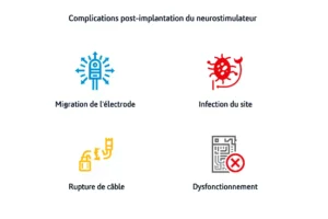 Complications du neurostimulateur